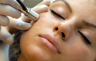 microdermabrasion2