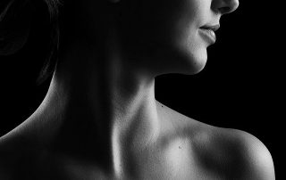 Neck Lift - Cosmetic Surgery