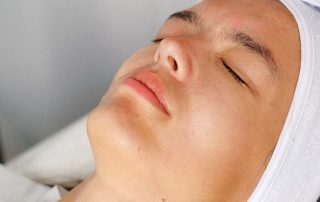laser skin resurfacing