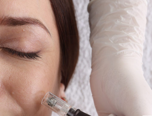 How Many Microneedling Sessions Are Needed to See Results?